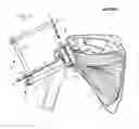 Fig. 12 - Method of humeral head resurfacing and/or replacement and system for accomplishing the method