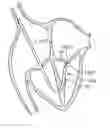 Fig. 01 - Mitral valve repair devices