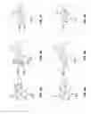 Fig. 09 - Mitral valve repair devices