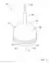 Fig. 02 - Circumcision instrument