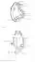 Fig. 04 - Circumcision stapler