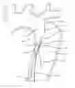 Fig. 01 - Aortic dissection septal cutting tool