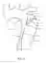Fig. 04 - Aortic dissection septal cutting tool