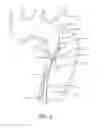 Fig. 06 - Aortic dissection septal cutting tool
