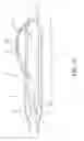 Fig. 16 - Aortic dissection septal cutting tool