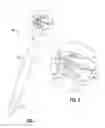 Fig. 02 - OBTURATOR WITH INSTRUMENT RETENTION