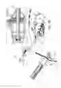 Fig. 11 - PERICARDIAL ACCESS DEVICE