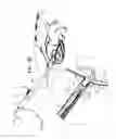 Fig. 14 - PERICARDIAL ACCESS DEVICE