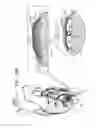 Fig. 24 - PERICARDIAL ACCESS DEVICE