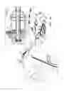 Fig. 10 - PERICARDIAL ACCESS DEVICE