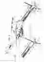 Fig. 15 - PERICARDIAL ACCESS DEVICE
