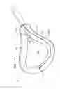Fig. 20 - PERICARDIAL ACCESS DEVICE