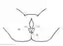 Fig. 01 - Device and Methods to Reduce Vaginal Tearing During Delivery