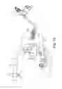 Fig. 11 - Vaginal manipulator with a head extender