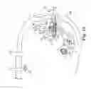 Fig. 12 - Vaginal manipulator with a head extender