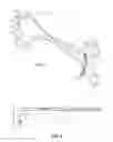Fig. 02 - SURGICAL INSTRUMENT WITH MOVABLE GUIDE AND SLEEVE