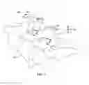 Fig. 06 - Minimally invasive spinal column realignment system and method