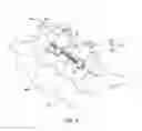 Fig. 07 - Minimally invasive spinal column realignment system and method