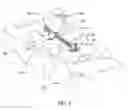 Fig. 08 - Minimally invasive spinal column realignment system and method