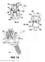 Fig. 06 - Conforming bone stabilization receiver