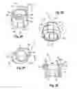 Fig. 09 - Polyaxial bone anchoring device