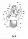 Fig. 06 - Vertebral fixation device