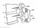 Fig. 01 - SURGICAL TETHER APPARATUS AND METHODS OF USE