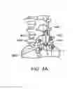 Fig. 06 - SURGICAL TETHER APPARATUS AND METHODS OF USE