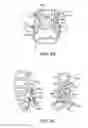 Fig. 07 - SURGICAL TETHER APPARATUS AND METHODS OF USE