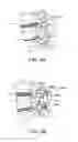 Fig. 09 - SURGICAL TETHER APPARATUS AND METHODS OF USE