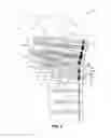 Fig. 06 - Fixation device for proximal humerus fractures