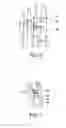 Fig. 03 - METHOD AND DEVICE FOR CORRECTING BONE DEFORMITIES