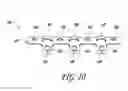 Fig. 06 - METHOD AND DEVICE FOR CORRECTING BONE DEFORMITIES