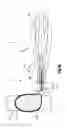 Fig. 03 - Tensioning instrument and related bone fixation systems and methods