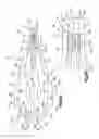 Fig. 06 - Tensioning instrument and related bone fixation systems and methods