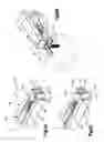 Fig. 09 - Tensioning instrument and related bone fixation systems and methods