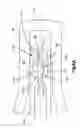 Fig. 10 - Tensioning instrument and related bone fixation systems and methods
