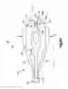 Fig. 22 - Tensioning instrument and related bone fixation systems and methods