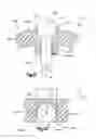 Fig. 26 - Tensioning instrument and related bone fixation systems and methods