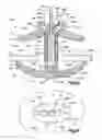 Fig. 28 - Tensioning instrument and related bone fixation systems and methods