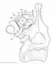 Fig. 01 - Bone fixing system and method of use