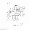 Fig. 05 - Bone fixing system and method of use
