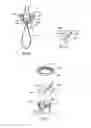 Fig. 13 - Bone fixing system and method of use