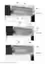 Fig. 10 - Methods and devices for applying energy to bodily tissues