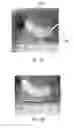Fig. 12 - Methods and devices for applying energy to bodily tissues