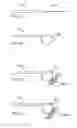 Fig. 14 - Methods and devices for applying energy to bodily tissues