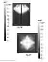 Fig. 20 - Methods and devices for applying energy to bodily tissues