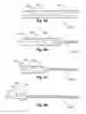 Fig. 25 - Methods and devices for applying energy to bodily tissues