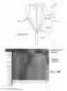 Fig. 50 - Methods and devices for applying energy to bodily tissues