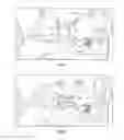 Fig. 02 - System and Device for A Fully Automated Approach to Facilitate Stellate Ganglion Block or Pulsed Radiofrequency Procedure for Treating PTSD